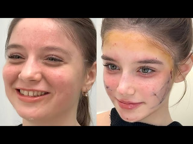 drastically beautifying and reconstructing your face until you reach your full potential 💉🎀