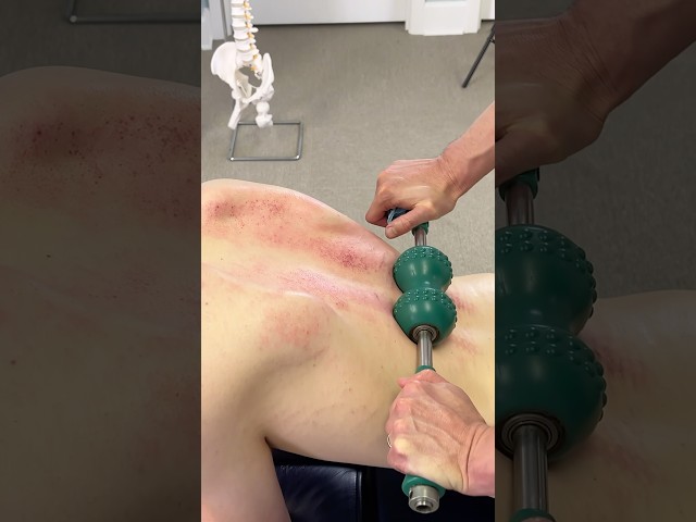 LOUD *CRACKS* 😳 Steamrolling A Tight Back!! #shorts #chiropractor