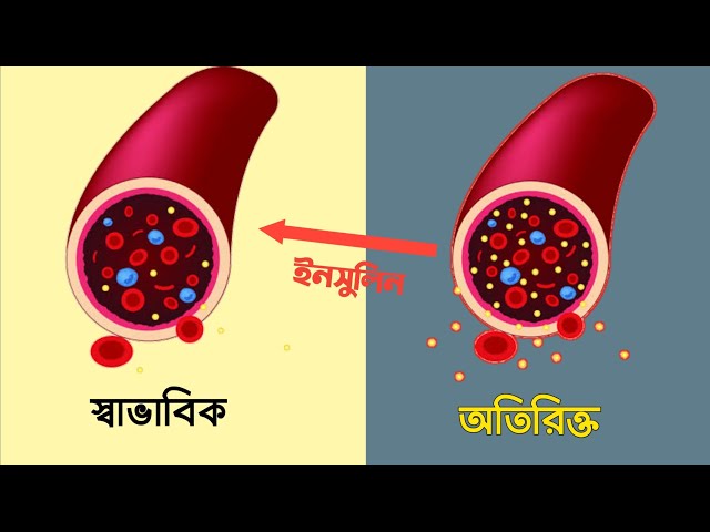 Blood Glucose Regulation By Insulin | Diabetic