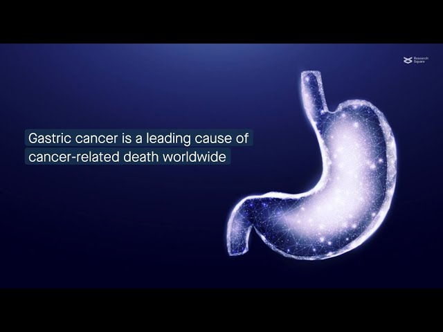 Microvesicles help stem cells deliver gastric cancer-promoting payloads