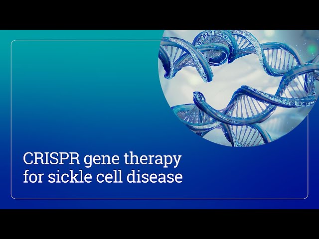 CRISPR gene therapy for sickle cell disease | Mass General Brigham