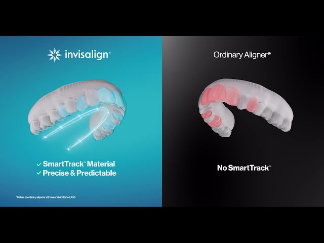 Invisalign | 5 Test Check - Material