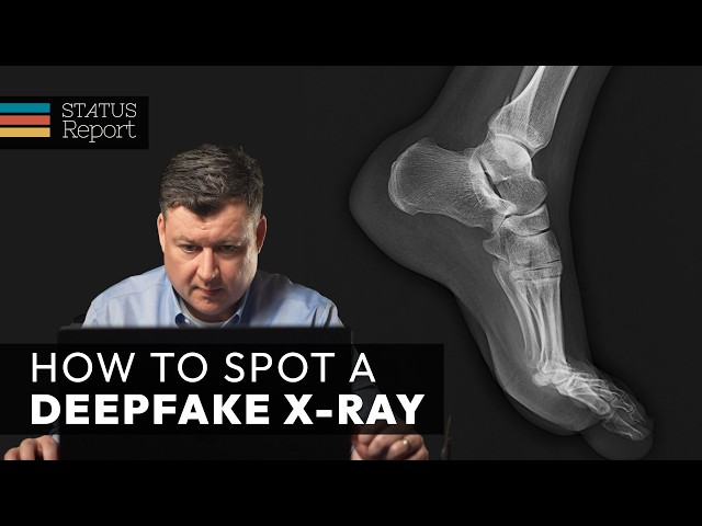 Could fake X-rays become a problem?