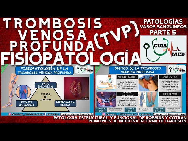DEEP VEIN THROMBOSIS PATHOPHYSIOLOGY | GuiaMed