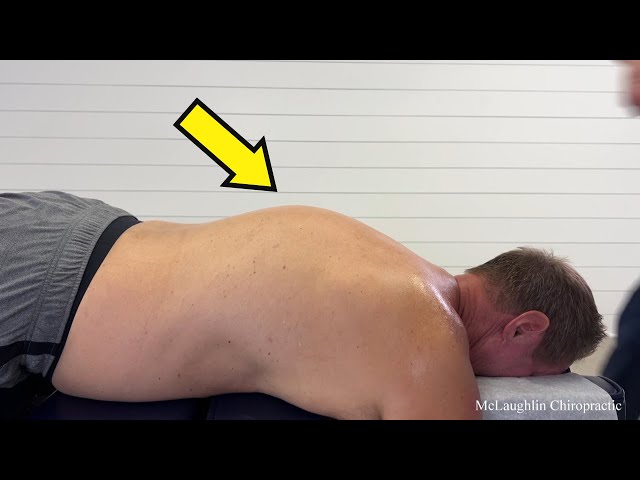 Tall People PROBLEMS! Hyperkyphosis LOCKS His Back 😳 STRETCHING & CRACKS Help A Rounded BACK