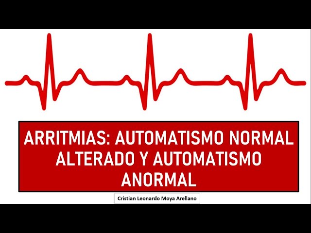 🔴 ARRITMIAS: AUTOMATISMO NORMAL ALTERADO Y AUTOMATISMO ANORMAL