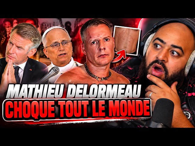 Matthieu Delormeau reappears and shocks the internet 😳