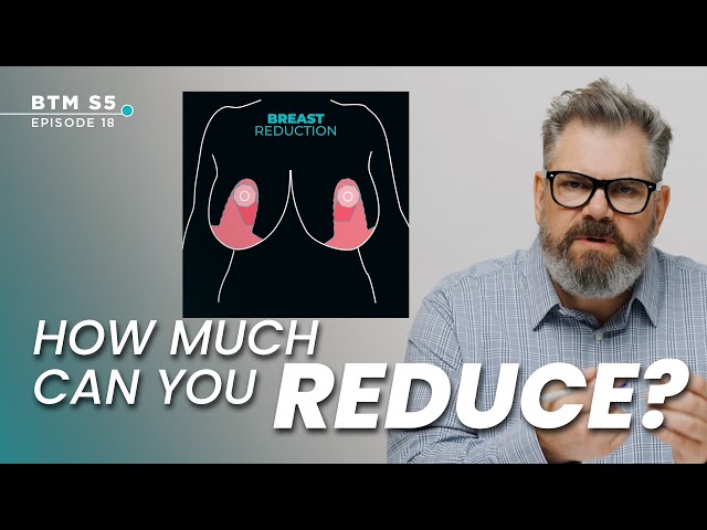 How Many Cup Sizes Can You Drop with Breast Reduction?  | BTM5 Ep.18 #drwilliam