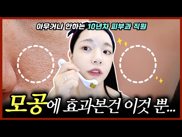 모공부자들 안보고 뭐해요..?😦피부과 안가고 집에서 쉽게 모공 줄이는 튜토리얼ㅣ패인여드름흉터,피부탄력,모공관리,MTS 홈케어ㅣ모공줄이는법