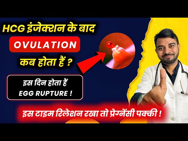 When does the egg rupture after the HCG injection? Ovulation after the HCG trigger shot