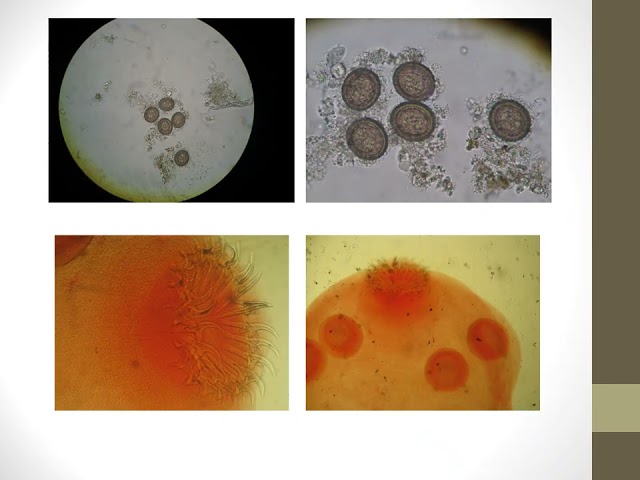 Computerized Lab 3/3: Filaria, Trematodes & Cestodes | Parasite ID + Quiz