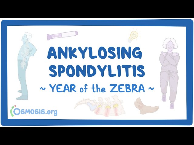 Ankylosing spondylitis (Year of the Zebra 2024)