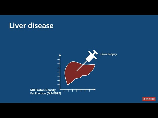 Philips Ultrasound Liver Fat Quantification Value Proposition