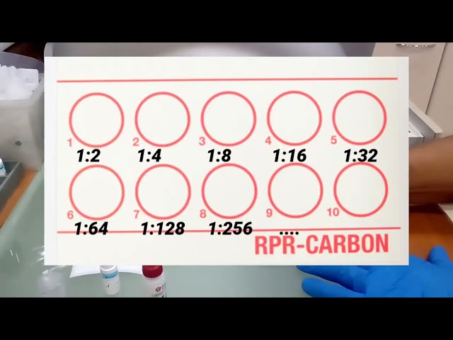 RPR TEST, Explanatory procedure for taking the exam. Includes qualification.