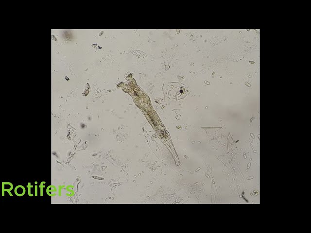 Tiny Killers: Parasites Under the Microscope