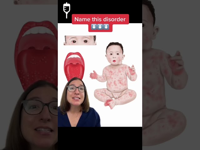 Name this disorder! #30: Pediatrics SHORT | @LevelUpRN