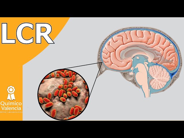 Cerebrospinal fluid (CSF): Chemical, cytological and culture analysis