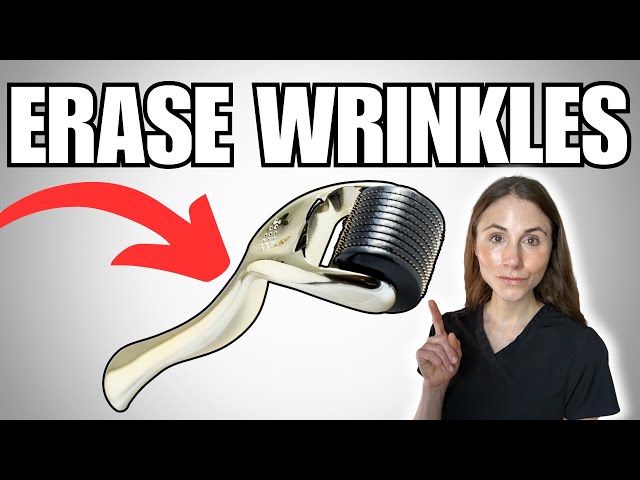 Erase Wrinkles, Stretch Marks, And More | Microneedling Explained