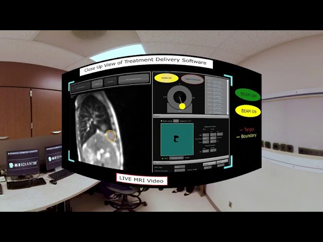 Part 3/3 - Intro to ViewRay MRIdian MR image guided Radiation Treatment (RT) - HFHS Virtual Tour