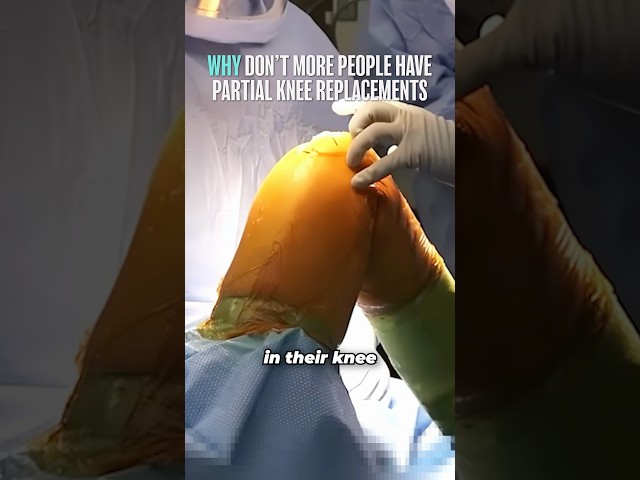 5 Reasons Robotic Partial Knee Replacement Changes Everything #shorts