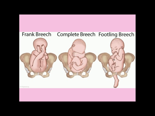 Normal Labor and Delivery - CRASH! Medical Review Series