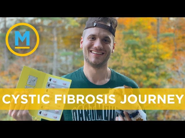 Cystic fibrosis patient shares how new drug changed his life within 10 hours | Your Morning
