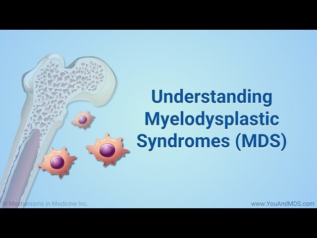 Understanding Myelodysplastic Syndromes (MDS)