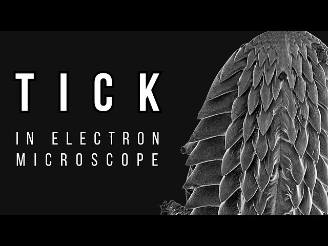 You Will Regret Watching This Tick at 5000x Magnification