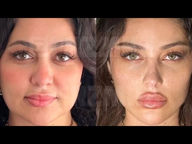 extreme facial sculpting and snatching procedure 💉 ୨୧ experimental [1x MAX]