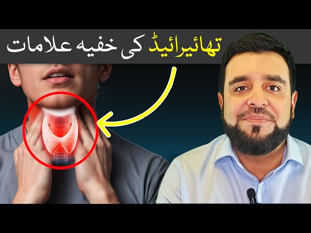 Hypothyroidism: Never Ignore THESE Symptoms of Thyroid: Causes & Treatment | گلہڑ کیا ہوتا ہے