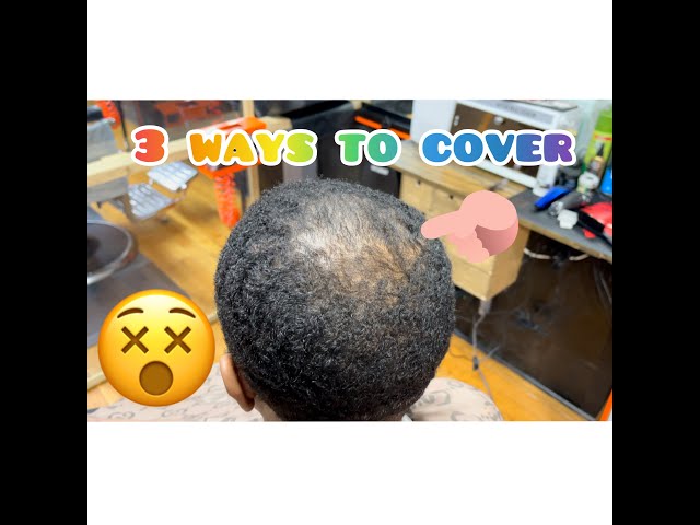3 Ways to cover bald spot #barber #bald #tutorial #cheap