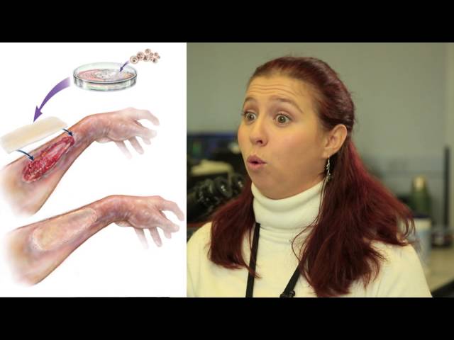 Bio-engineered scaffolding for skin