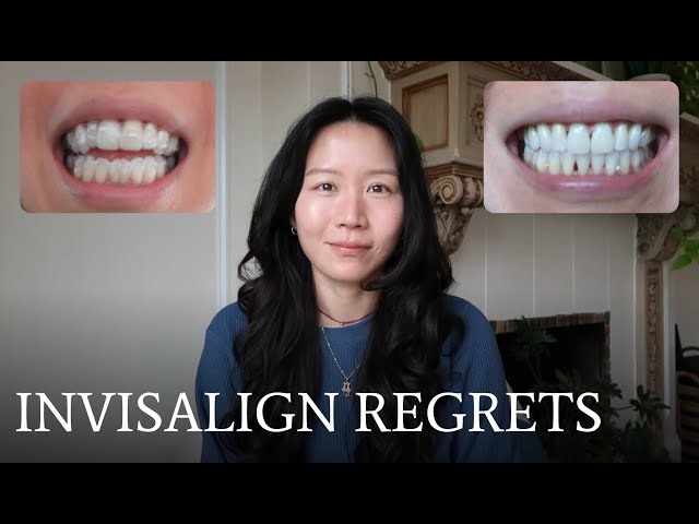 Invisalign review | 2 years later...was it worth it?