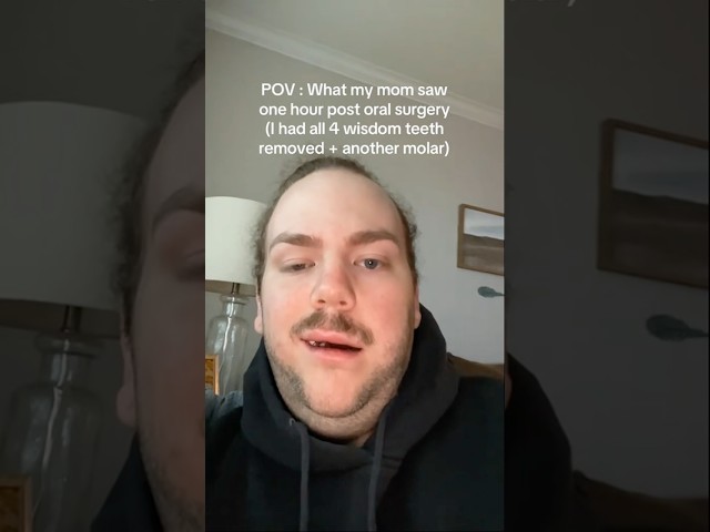 He Got His Wisdom Teeth Removed, Now He CAN’T Blink! 😮🦷