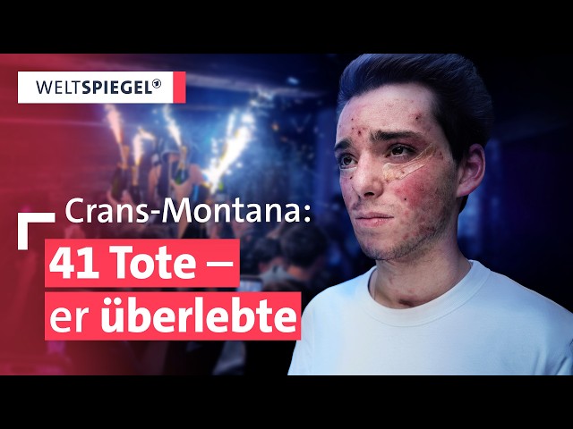 Crans-Montana – So kämpft sich Valentin nach dem Brand zurück ins Leben | Weltspiegel Doku | Teil 1