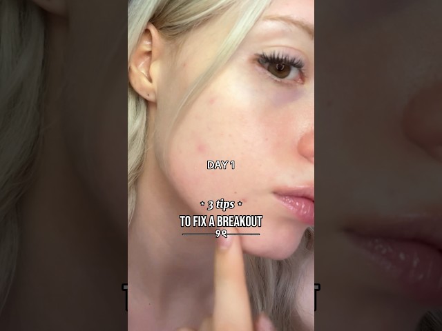 how i fixed my breakout in 3 days! 💌 #acne #darkspots #foru
