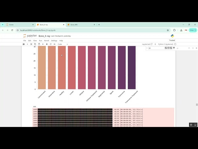 Bone X Ray Jupiter in Python Projects