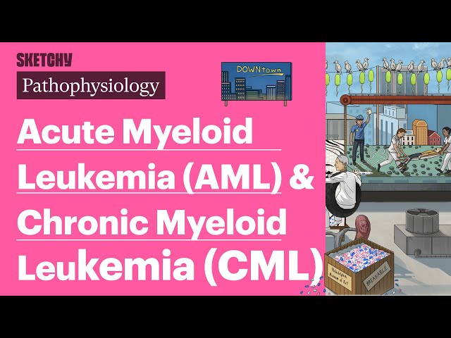 Acute Myeloid Leukemia (AML) & Chronic Myeloid Leukemia (CML) (Pathophysiology) | Sketchy Medical