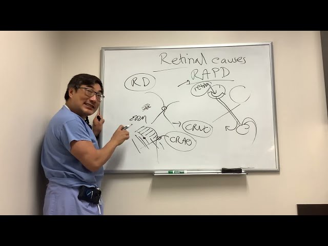 Retinal causes of RAPD