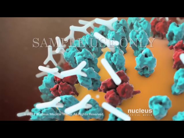 Influenza - The Flu