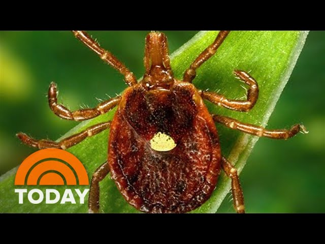 How A Bite From A 'Lone Star' Tick Can Trigger Severe Allergy To Meat
