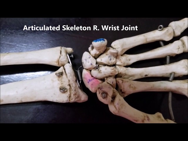 WRIST Joint Radiocarpal CMC MCP Articulations Functional and Clinical Aspects – Sanjoy Sanyal