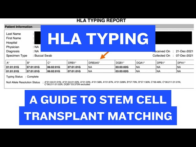 What is HLA typing?