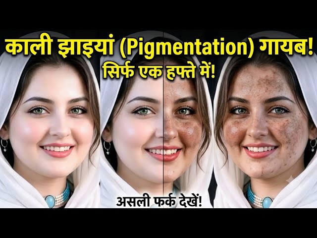Mix This 1 Ingredient With Potato Before Bathing 😱 Eliminate Dark Spots and Pigmentation in 3 Day...