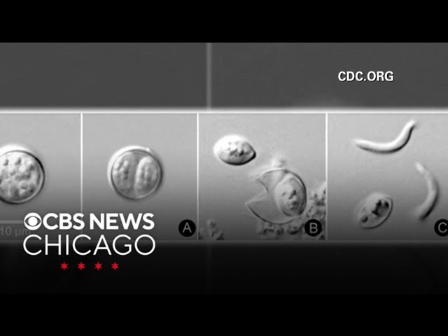Cyclosporiasis parasite spreads to at least 17 states