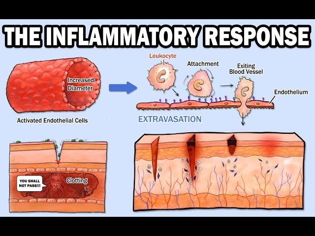 THE INFLAMMATORY RESPONSE