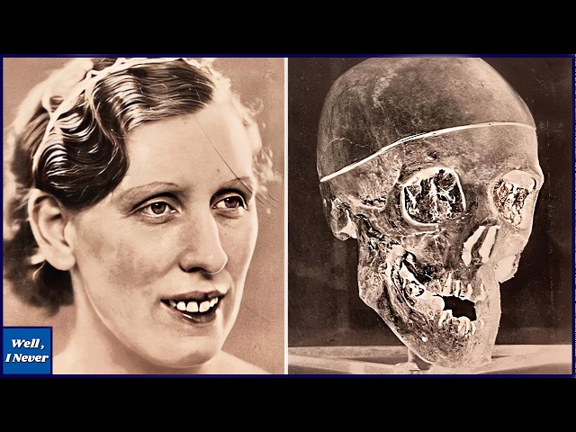 Piecing Their Bodies Back Together Revealed the Victims and Their Killer.