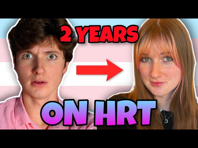 2 años de terapia de reemplazo hormonal | MTF transgénero