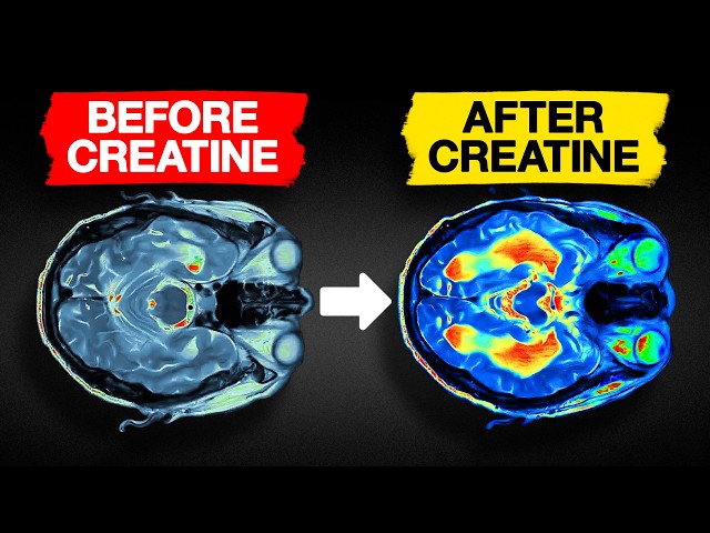 Why Even My Grandma Is Taking Creatine Daily!