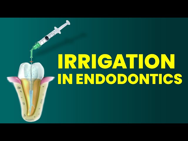 Why Your Endodontic Irrigation Isn’t Working